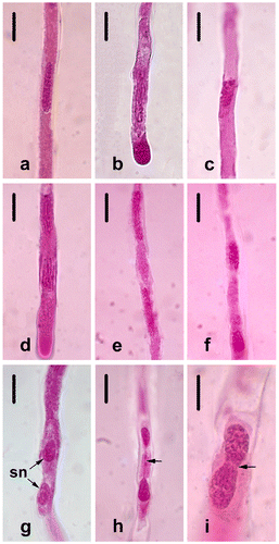 Figure 8. (Color online) Spermatogenesis of Fritillaria stribrnyi in in vitro germinated pollen tube. (a) Prophase; (b) prometaphase; (c) metaphase; (d) anaphase; (e) telophase; (f) the end of telophase; (g) two sperm nuclei; (h) telophase bridge (arrow); (i) telophase bridge (arrow) Scale bars: (a–h) 20 μm; (i) 10 μm.