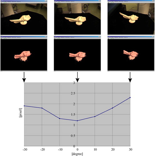 Figure 8. Average errors between real and virtual objects in the navigated image. The phantom model was created from CT data of the elbow. The virtual object was directly reconstructed from a mobile 3D-CT scan. [Color version available online.]