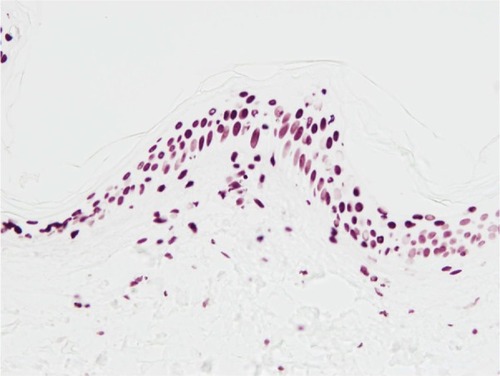 Figure 3 Immunostaining of thymine dimers in the epidermis (batch with Centella asiatica extract, day 6).
