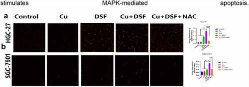 Figure 4. The apoptosis of GC is partly reversed by NAC. HGC-27 and SGC-7901 were exposed to Cu (0.2 μM), DSF (0.24 μM, 0.3 μM), or DSF + Cu (0.24 μM, 0.3 μM + 0.2 μM) for 24 h. NAC was pretreated for 12 h. (a, b) Apoptotic cells were photographed using fluorescence microscopy. Scale bar: 100 µm. Data are expressed as mean ± standard deviation of three independent experiments. * p < 0.05 vs. the DSF/Cu group.