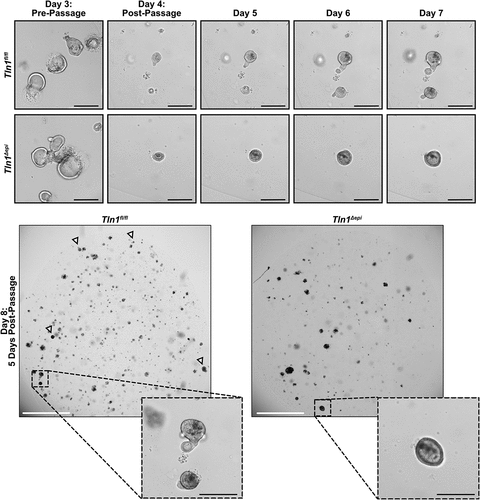 Figure 9. Epithelial talin-1 deficiency inhibits epithelial cell mobility in vitro. Representative images of colon organoids (colonoids) generated from crypts isolated from Tln1fl/fl and Tln1Δepi mice and imaged daily for 8 days; n = 3 mice per genotype. Arrowheads highlight colonoids with budding. White scale bars represent 2000 μm and black scale bars represent 100 μm.