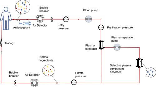 Figure 3 The principle of plasma adsorption (PA). Blood that has gone through a plasma separator is washed out of the blood with selective adsorbents and returned directly to the body.