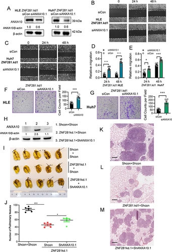 Figure 5 Knockdown of ANXA10 attenuated the effect of ZNF281 depletion on inhibiting migration, invasion and metastasis of HCC cells. (A) Western blot for ANXA10 expression upon ANXA10 depletion in ZNF281kd.1 HCC cells. (B and C) Wound healing assays (10×) in ZNF281kd.1 HLE or Huh7 cells subjected to ANXA10 siRNA. (D and E) Quantification of (B and C) as mean ± SEM (n=3; *p < 0.05, ***p < 0.001). (F and G) Matrigel transwell assays (4×) in ZNF281 knockdown HLE and Huh7 cells transfected with scramble control or ANXA10 siRNA. The quantification was shown in the right panel (n=3; ***p < 0.001). (H) Expression of ANXA10 in HLE cells with different shRNA transfection as indicated. (I) Resected lungs for indicated groups. Arrows indicated the pulmonary metastatic nodules with macroscopic observation. (J) Statistical analysis of the pulmonary nodules in different groups as indicated (*p < 0.05, ***p < 0.001). (K and M) Representative images of HE staining for the resected lungs. Scale bars: 500 μm.