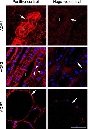 Figure S1 AQP expression in healthy human tissues.Notes: The left panel (positive controls) shows micrographs with immunofluorescence labeling of human samples with AQP1, AQP3, and AQP7 antibodies. The tubular lumina are marked L. AQP1 is localized at the brush border and basolateral membranes of the renal proximal tubule (arrow, upper panel), AQP3 is localized at the basolateral membranes of the collecting ducts (arrowheads, middle panel) and AQP7 is localized at the plasma membrane of dipocytes (arrow, lower panel). The right panel (negative controls) shows sections from the same tissue as in the left panel, treated the same way, in absence of the primary antibody. No labeling is observed, excluding nonspecific labeling with the secondary antibodies. Scale bar: 50 μm.Abbreviation: AQP, aquaporin.