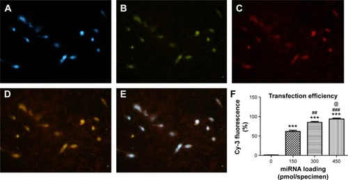 Figure 5 Uptake of HA/CS/miR-21 nanoparticles by cells.Notes: Fluorescence images showing the cellular uptake of miR-21 after 24 hours of transfection in the reverse-transfection formulation of 450 pmol/specimen. (A) DAPI-labeled nuclei (blue). (B) FITC-labeled CS/HA nanoparticles. (C) Cy3-labeled miR-21 (red). (D) Merged images of (B) and (C). (E) Merged images of (A–C). (F) Comparison of the transfection efficiency among different specimens by flow cytometry. ***P<0.001 versus the naked MAO surface; ##P<0.01 and ###P<0.001 versus the 150 pmol miR-21 specimen group; @P<0.05 versus the 300 pmol miR-21 specimen group.Abbreviations: CS, chitosan; HA, hyaluronic acid; DAPI, 4′,6-diamidino-2-phenylindole; FITC, fluorescein isothiocyanate; miR-21, microRNA-21.
