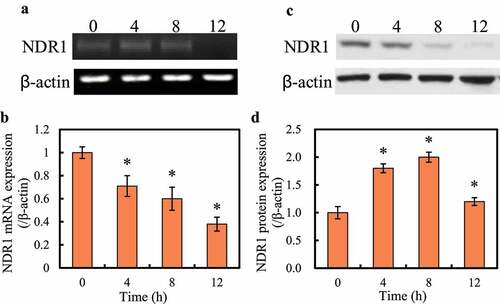Figure 2. Changes of NDR1 expression in RAW264.7 cells at different times after RSV virus infection