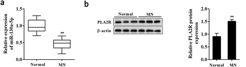 Figure 1. Renal expression patterns of miR-130a-5p and PLA2R in MN.(a) The expression of miR-130a-5p in renal biopsy specimens from MN patients (n = 30) or 30 controls was detected using qRT-PCR. (b) Western blot analysis of PLA2R expression in renal biopsy specimens from MN patients (n = 30) or 30 controls. **P < 0.01 compared with the control (Normal).