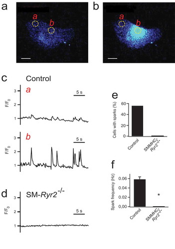 Figure 3. Ca2+ sparks in wild-type and smooth muscle myosin heavy chain (SMMHC)–Ryr2−/- tibial artery smooth muscle cells (SMCs). (A) Ca2+ fluorescence image of a Fluo-4-AM–loaded control SMC. (B) Ca2+ fluorescence image of the same cell as in A during the occurrence of a Ca2+ spark. Two-dimensional images were recorded at a rate of 5/s using an inverted microscope (Nikon Eclipse Ti, oil immersion objective x40, numerical aperture 1.3;) as described in [Citation6]. (C) Time course of Ca2+ fluorescence changes in cellular regions of interest (ROIs) without sparks (ROI a, left) and with sparks (ROI b, right). (D) Time course of Ca2+ fluorescence changes in an ROI (similar size as that in A) of a SMMHC-Ryr2−/- SMC. (E) Percentage of SMCs with Ca2+ sparks. (F) Ca2+ spark frequencies in SMCs from control and SMMHC-Ryr2−/- mice. F/F0, fluorescence/background fluorescence. Bar, 2 µm. *P < 0.05. Modified from [Citation6].