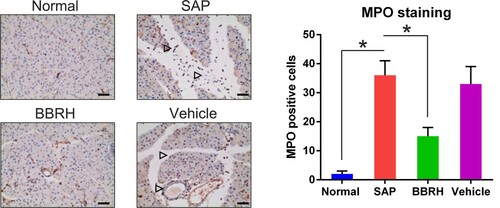 Figure 3. Effects of BBRH on pancreatic neutrophil infiltration observed after MPO staining. Representative IHC images of the MPO stained pancreas. The frequencies of pancreatic MPO-positive cells are calculated. Scale bar, 50 µm. Result is presented in the form of mean ± SD (n = 15 per group). Differences among various groups are assessed using ANOVA. *P < 0.05.