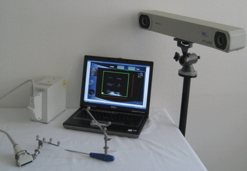 Figure 9. Components for sononavigation: ultrasound device with navigated scanner (left), navigated pointer, PC with custom software (center), and Polaris coordinate tracker (right).