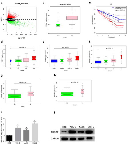 Figure 1. The expression level of TROAP is up-regulated in ccRCC (a): Volcano map of DEmRNAs in ccRCC, the red dots represent up-regulated mRNAs, and the green dots represent down-regulated mRNAs; (b): The expression of TROAP in ccRCC; (c): Survival curves of TROAP expression on the prognosis of patients; (d-h): Box plots of TROAP expression in different G, stage, T, M, and N stages of ccRCC, respectively; (i): The results of qRT-PCR detection of mRNA expression of TROAP in human renal tubular epithelial cell line HKC and three ccRCC cell lines including A498; (j): The results of western blot of protein expression of TROAP in human renal tubular epithelial cell line HKC and three ccRCC cell lines including A498; * p<0.05