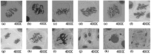 Figure 4. Types of chromosomal aberrations induced in Allium cepa meristems treated with silver nanoparticles. (a, b) irregular prophase; (c, d) c-metaphase; (e, f) disturbed anaphase; (g) sticky anaphase; (h) chromatin bridge; (i) chromosomal break and micronucleus in metaphase; (j) micronuclei in interphase; (k) uniucleate cell with two micronuclei (binucleate); (l) multinucleate cell in interphase.