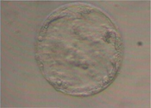 Figure 2 Microscope image (400× magnification) of blastocyst before embryo transfer (first cycle).