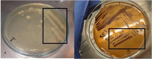 Figure 1. Qualitative screening of laccase production by G. stearothermophilus MB600 A = Control B = Nutrient agar supplemented with syringaldazine.