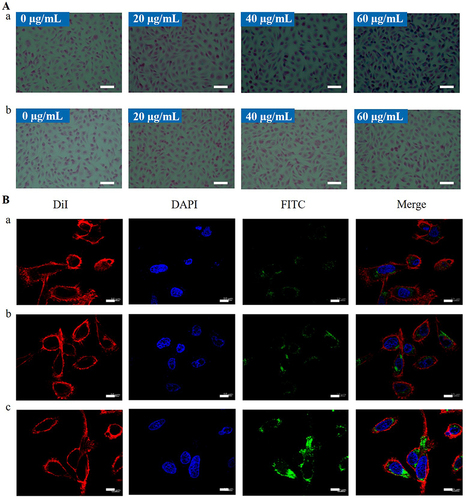 Figure 4 (A) Prussian blue-stained images revealed an efficient cellular uptake of SP94-Fe3O4@ICG&DOX nanoparticles at incubation concentration of 0, 20, 40 and 60 μg/mL of the nanoparticles for 4 h (blue: nanoparticles, red: cell nucleus) (scale bar = 100 μm): (a) SP94-Fe3O4@ICG&DOX nanoparticles, (b) Fe3O4@ICG&DOX nanoparticles; (B) Confocal laser scanning microscope images of Hepa1-6 cells after incubating with FITC labelled DOX (scale bar = 10 μm) (a), FITC labelled Fe3O4@ICG&DOX nanoparticles (b) and FITC labelled SP94-Fe3O4@ICG&DOX nanoparticles (c) for 4 h at 37 °C.