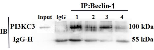 Figure 8 Co-immunoprecipitation to detect the expression levels and interactions of Beclin-1 and PI3KC3 in the different groups. This figure shows the result of detecting PI3KC3 with anti-PI3KC3 antibody as the primary antibody; inorganic phosphorus precipitated the Beclin-1 protein. Here, 1, 2, 3, and 4 represent the PDGF-BB group, control group, PDGF-BB + 3-MA group, and 3-MA group, respectively.