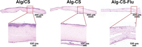 Figure 9 H&E staining images of transplanted Alg/CS, Alg-CS, and Alg-CS-Flu scaffolds after subcutaneous embedding in mice for 7 d.