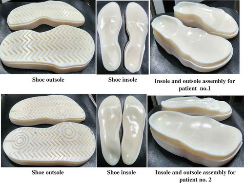 Figure 6. Prototype of the RP model for insole shoe orthotics.