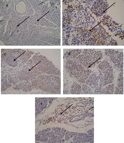 Figure 6. Localization of VP1 in the pancreatic tissue. (a) Absence of VP1 in the islet and exocrine tissue of a mock-infected pup of a dam mock infected on day 4/E.4 (−/−) (20×), pup sacrificed on day 5 p.i. (b) Presence of VP1 in the islet and exocrine tissue on day 3 p.i./E.20 of a dam infected with CVB4-E2 on day 17/E.17. (c) Presence of VP1 in the exocrine tissue but absence in the islet of virus challenged pup of a dam infected on day 10/E.10 (+/+), and of dam at day 17/E17. (d) Pups sacrificed on day 5 p.i. (20×). (e) Peripancreatic fat tissue showing VP1 positivity at day 5 p.i. in the pancreas of a virus challenged pup of a mock-infected dam (20×).