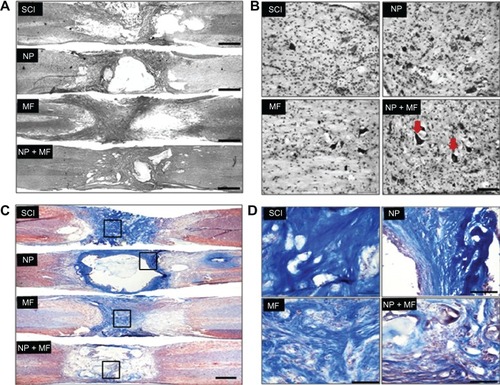 Figure 4 Histological analysis of lesion site. Representative images of stained sections from each group showing extent of the lesion (A) and presence of viable motor neurons (arrowhead) (B) in the NP + MF group. Masson’s trichrome staining for collagenous connective tissue (C). Dense collagenous staining was observed in the SCI and NP groups (D), indicating scar formation; this was significantly less in the MF group and was absent in the NP + MF group.Notes: Scale bar (A and C) = 1000 μm and (B and D) = 100 μm.Abbreviations: IONPs, iron oxide nanoparticles; SCI, spinal cord injury group; MF, SCI + magnetic field group; NP, SCI + IONP implantation group; NP + MF, SCI + IONP implantation + magnetic field group.