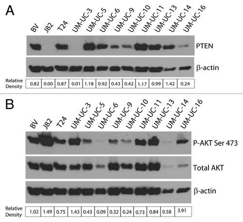 Figure 5. Potential predictors of response to AKT inhibition. (A) Western blot analysis of baseline PTEN status among the panel of 12 cell lines. The corresponding relative density indicates the PTEN band intensity relative to β-actin. (B) Western blot analysis of baseline AKT Ser 473 phosphorylation status among the panel of 12 cell lines. The corresponding relative densities indicate the phospho-AKT band intensity relative to total AKT.