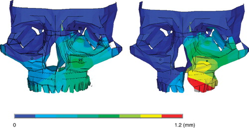 Figure 8.  Representative patterns of maxillary deviation for the intact model group (left column) and cleft model group (right column), respectively. The maxilla deviates more in the cleft model group than in the intact model group.