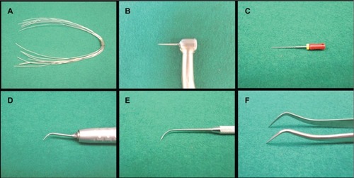 Figure 1 Typical sharp instruments. A) Stainless steel wires (0.4 mm in diameter). B) Dental turbine hand piece with diamond bur. C) File. D) Ultrasonic hand scalar with scalar tip. E) Explorer. F) Dental forceps.