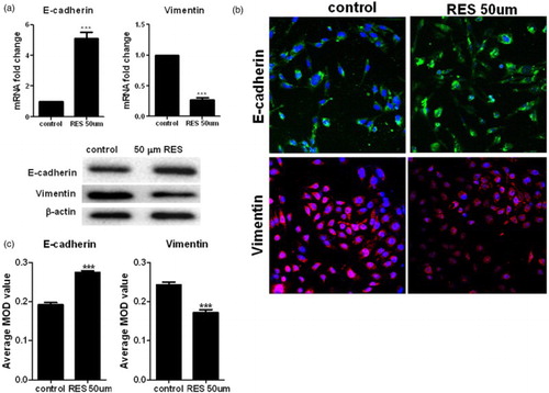 Figure 3. Resveratrol inhibits the EMT in prostate cancer cells. (a) Real-time PCR and Western blot analyses of the expression of E-cadherin and Vimentin in the cells. (b) Immunofluorescence detection of the E-cadherin and vimentin proteins in the PC-3 cells at ×200 magnification. Green and red indicates the protein of interest. Scale bars = 100 μm. (c) Quantification of E-cadherin and Vimentin expression using Image-Pro Plus 6.0 software. Statistical significance was assessed by the unpaired Student's t-test.
