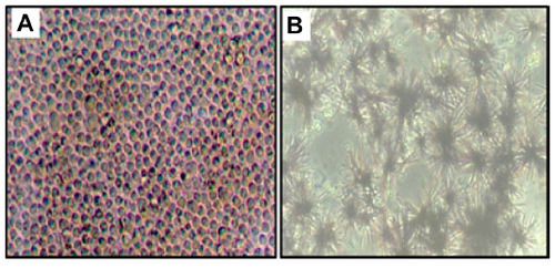 Figure 2 Photomicrographs showing 48-hour-cultured splenocytes (A) formation of formazan crystals (B) after addition of MTT to cultured splenocytes.