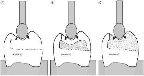 Figure 3. Schematic representation of onlay-shaped test specimens and the compressive load test setup. (A) Group made from plain composite resin; (B) group made of different composite base materials and 1 mm surface layer of composite resin; (C) group made only from short FRC resin.