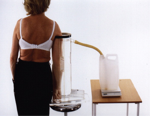 Figure 1. Measurement of arm volume with water displacement method.