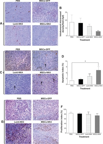 Figure 6 Effects of treatment with PBS, MSCs-GFP, Lenti-NK4, or MSCs-NK4 on intratumoral microvessel density, cellular apoptosis and proliferation in gastric cancer xenografts in nude mice.
