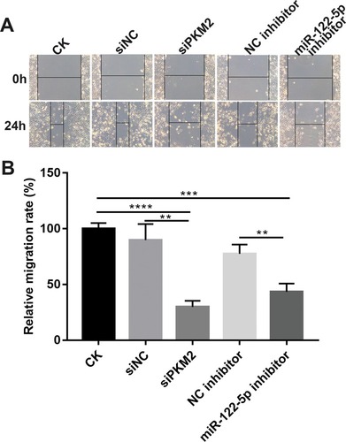 Figure 7 Knockdown of miR-122-5p or PKM2 inhibits renal cancer cell migration. (A and B) The migration ability was detected in 786-O cells transfected miR-122-5p inhibitor or siPKM2 for 24 hrs (**p<0.01; ***p<0.001; ****p<0.0001).