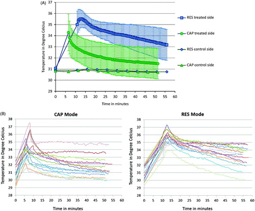 Figure 5. (A) Capacitive (CAP) and resistive (RES) mode mean skin thermal decay after localised 448 kHz capacitive resistive monopolar radiofrequency (CRMRF) treatment (treated side). The data are from 15 participants, showing the decay process from post treatment to 45-min follow-up. (B) Capacitive (CAP) and resistive (RES) mode individual skin thermal decay after localised 448 kHz capacitive resistive monopolar radiofrequency (CRMRF) treatment (treated side). The data are from 15 participants, showing the decay process from post treatment to 45-min follow-up.