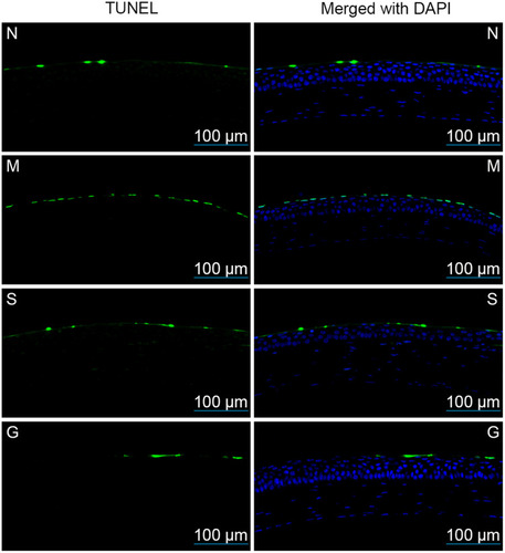 Figure 14 The apoptosis rate of corneal epithelial cells after 7 days of the administrations (N: the normal group; (M) the model group; (S) the solution group; (G) the gel group. The green fluorescence indicated the nucleus of positive apoptotic cells while blue fluorescence represented the nucleus of other cells.).