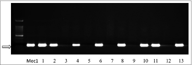 Figure 2. Representative PCR reactions for LMP1 of EBV in 13 different breast cancer tissue samples. LMP1 and EBNA1 are present in 8 of 13 samples (line 1: Mec1 cell line was used as a positive control; MCF7 and normal mammary epithelial cells were used as negative controls, data not shown).