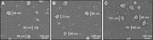 Figure 4 SEM images of ND (A), NDCONH(CH2)2NH-VDGR (B), and NDCONH(CH2)2NH-VDGR/survivin-siRNA (C).Abbreviations: SEM, scanning electron microscopy; ND, nanodiamond; siRNA, small interfering RNA.