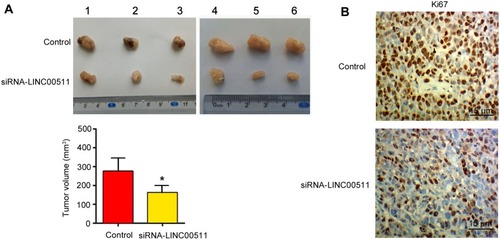 Figure 5 Silencing LINC00511 inhibited CAOV3 tumor growth in nude mice. CAOV3 cells were transfected with siRNA-LINC00511. Then, cells were injected into nude mice. (A) Tumor volume was measured on day 16. (B) IHC detected Ki67 expression in the tumor. *P< 0.05 vs control (n = 6).