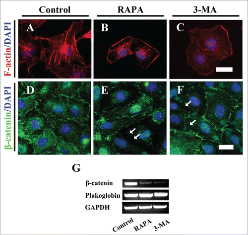 Figure 9. Both exposures of RAPA and 3-MA impaired the integrality of HUVECs. (A-C) The F-actin immunofluorescent staining was performed on the HUVECs after 8-h incubation of 0.1% DMSO as control (A), RAPA-treated (B) and 3-MA-treated (C) groups respectively. (D-F) The representative β-catenin fluorescent images + DAPI staining of HUVECs after 8-h incubation of 0.1% DMSO as control (D), RAPA-treated (E) and 3-MA-treated (F) groups respectively. (G) The RT-PCR data showing the expressions of Plakoglobin, β-catnin and GAPDH. Scale bars = 20 µm in A-C and 30 µm in D-F.
