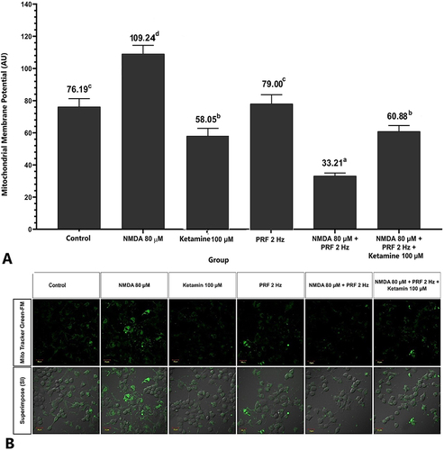 Figure 8 PRF decreases mitochondrial membrane potential (Δψm) in sensitized DRG neurons. (A) Sensitized neuron had the highest Δψm compared to the other groups. Sensitized neurons exposed to PRF had lower Δψm intensity than unexposed neurons. (B) Fluorescent imaging show lower Δψm intensity. The abcd notation indicates statistical differences between groups. Description: Superimpose (SI): description of the combined observations of Δψm and DIC (differential interference contrast) observations. Magnification: 400X.