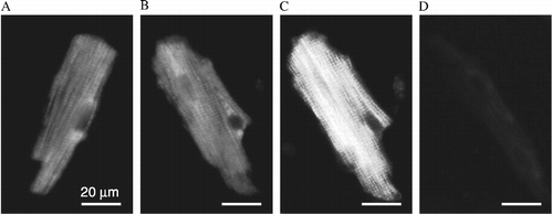 Figure 4 Identification of PNMT in cardiomyocytes by immunofluorescence. (A), (B), incubated with primary anti-rabbit PNMT antibody and anti-rabbit Alexa 488-conjugated secondary antibody; (C), same myocytes as in (B), but illuminated in polarized light; and (D), negative control (no primary antibody).