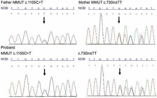 Figure 1. Molecular diagnosis results of the family. The loci of the mutations c.730insTT and c.1105 C > T are the nucleotides with a black arrow. Compared with the reference sequence of National Center for Biotechnology Information (NCBI), the father had a heterozygous mutation c.1105 C > T in MMUT, the mother had another heterozygous mutation c.730insTT in MMUT, and the proband inherited both c.1105 C > T and c.730insTT.