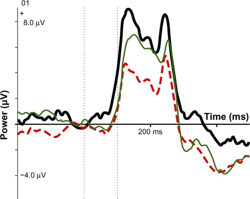 Figure 3 ERP IC early visual: SE group (thick black line), no-SE group (dotted red line), normal controls (thin green line).