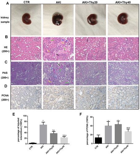 Figure 2. Gross and histopathological changes in different groups. (A) Isolated rat kidneys from the different experimental groups. (B, C) H&E and PAS staining (×200) showed tubular injury involving the loss of microvilli, tubular dilatation, tubular necrosis, and detachment (blue arrow), naked tubular basement membrane (black arrow), cellular micro debris into the tubular lumen (green arrow), tubular casts (yellow arrow), and interstitial inflammation. Thymol treatment significantly ameliorated the above tubular lesions. (D) The expression of PCNA detected by immunohistochemistry in renal tissue. (E) Quantitative analysis of tubular injury. (F) Quantitative analysis of PCNA-positive tubular epithelial cells. CTR: kidney section from the normal rats; AKI: kidney section from the AKI rats. AKI + Thy20: AKI rats treated with 20 mg/kg thymol. AKI + Thy40: AKI rats treated with thymol 40 mg/kg. Statistical significance: *p < .05 versus the control group; #p < .05 versus the AKI group. &p < .05 versus the AKI + Thy20 group.