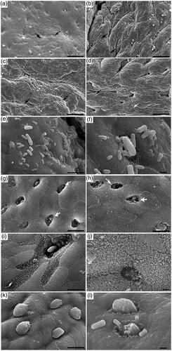 Figure 2. Scanning electron microscopy of appendix tissue cells from different dietary treatments (Diet I: 34.65% NDF; Diet II: 30.75% NDF; Diet III: 28.63% NDF; Diet IV: 25.85% NDF). (a–d) M cell morphology in diets I, II, III and IV, respectively (bar, 50 µm). (e, f) Rod-shape bacteria associated with enterocytes and M cells in the appendix (bar, 5 µm in e and 1 µm in f). (g–j) Morphological features of M cells in Diet I (g and i) and Diet IV (h and j) (bar, 5 µm in g–i and 1 µm in j). There were damaged M cells, with large cavities and no microvilli (open arrows). The surface of some M cells was covered with mucous (k). Luminal bacteria located in the microvilli were visible (I) (bar: 5 µm in k and 1 µm in i).