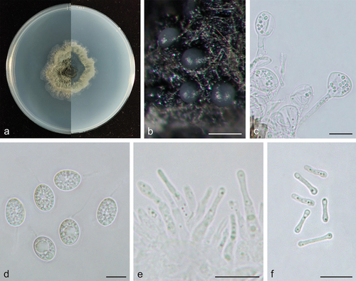 Figure 2. Phyllosticta endophytica (holotype, CAF 8000201). a: Colonies (left-above, right-reverse) after 7 days on PDA; b: Conidiomata; c: Conidiogenous cells; d: Conidia; e: Spermatogenous cells producing spermatia; f: Spermatia. Scale bars: 200 μm (b); 10 μm (c–f).