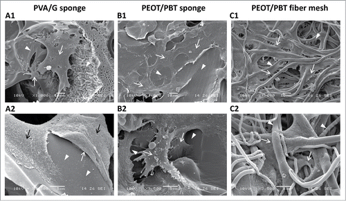 Figure 3. SEM micrographs of PDAC cell/scaffold constructs: (A) PVA/G sponge, (B) PEOT/PBT sponge, and (C) PEOT/PBT fiber mesh. Zoomed-out micrographs highlight interactions between cells and poral structures (A1–C1), while zoomed-in micrographs image single cells (A2–C2). Arrows indicate cells; arrowheads indicate scaffold surfaces.