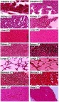 Figure 10 Histopathological examination of vital organs of rabbits after administration of β-CD-g-MAA NC networks (BM-8) (5 g/kg) in control group (C) and treated group (T).Abbreviations: CD, cyclodextrin; MAA, methacrylic acid; NC, nanocomposite.