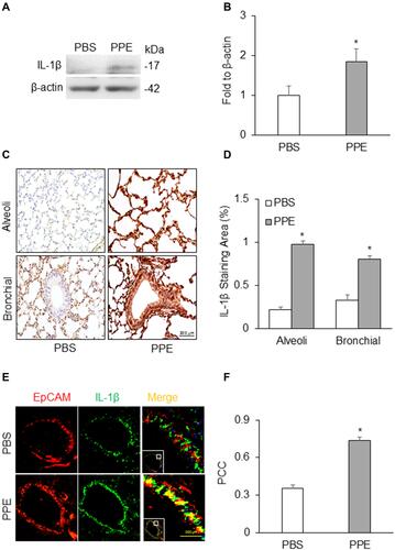 Figure 3 NLRP3 inflammasome activation in the lung. (A) Semiquantitative immunoblots reacted with anti-IL-1β antibodies. β-actin was used as internal loading control. (B) Corresponding densitometric analyses of protein expression levels of cleaved IL-1β normalized by β-actin (n=3). (C) Representative micrographs depict IL-1β immunostaining in the alveolar and bronchial wall of lung. (D) Summarized bar graphs shows PPE significantly increased IL-1β immunostaining. (E) Representative micrographs depict colocalization of EpCAM and IL-1β in the bronchial epithelium in the lung. (F) Bar graph shows PCC of EpCAM and IL-1β significantly increased in the lung of mice receiving PPE instillation (n=5–7). *P<0.05 vs PBS treatment.