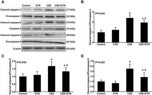 Figure 5 Etanercept attenuated the apoptosis of CSE-induced HPAECs via regulating levels of cell apoptosis-related caspases. (A) Protein expressions of cleaved caspase-3, cleaved caspase-8, and cleaved caspase-9 after CSE exposure and ETN treatment were measured by Western blot. β-Actin was used as the internal control. (B–D) Ratios of cleaved-caspase-3/procaspase-3 (B), cleaved-caspase-8/procaspase-8 (C), and cleaved-caspase-9/procaspase-9 (D) were determined. All experiments were performed in triplicate and experimental data were expressed as mean ± standard errors (SE). *P<0.05, vs control; #P<0.05, vs CSE.